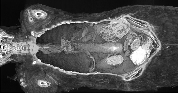 The “pregnant mummy” from Warsaw reassessed: NOT pregnant. Radiological  case study, literature review of ancient feti in Egypt and the pitfalls of  archaeological and non-archaeological methods in mummy studies |  Archaeological and