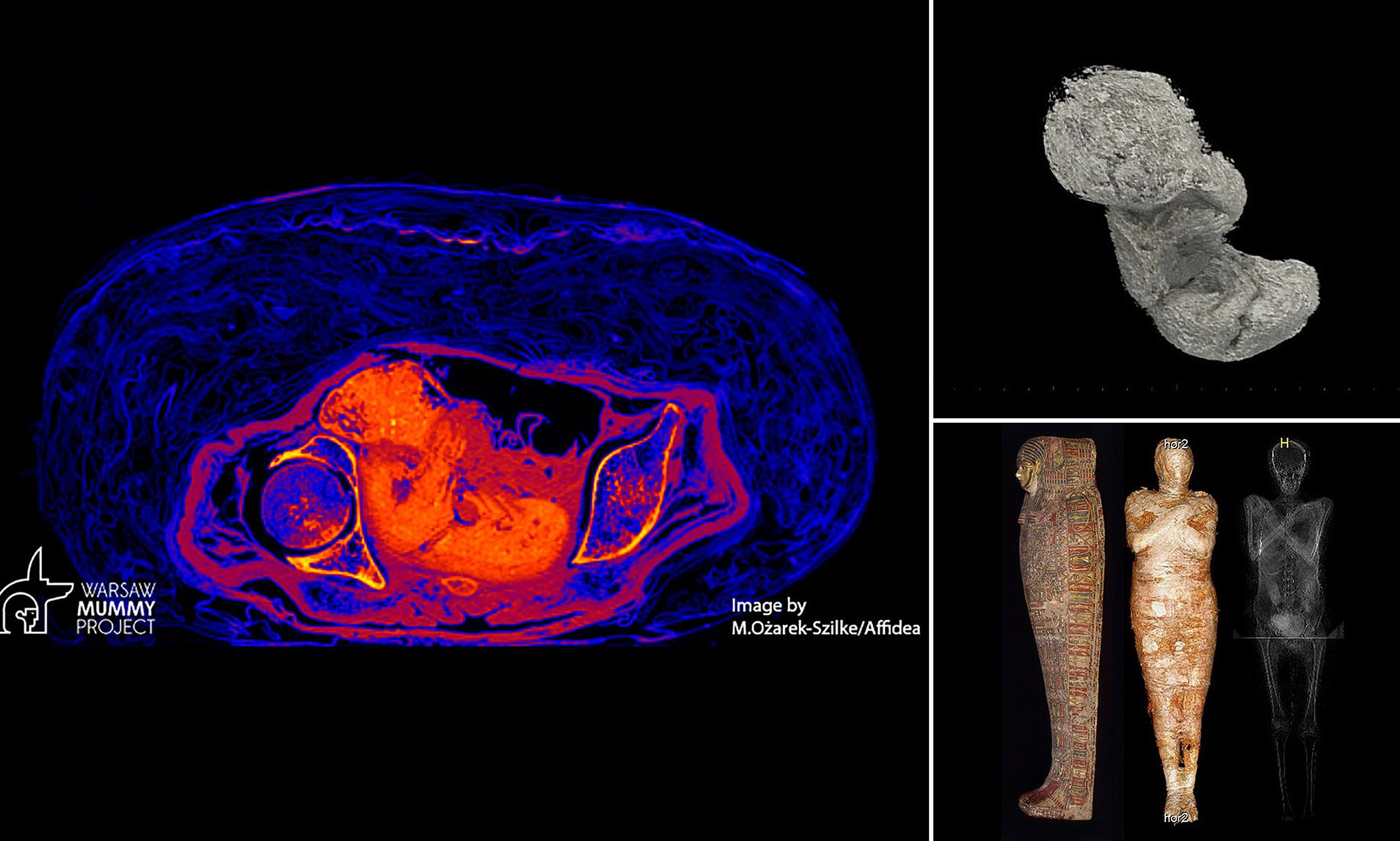 Archaeology: Foetus preserved within an Egyptian mummy was 'PICKLED' by  acidification, study reveals | Daily Mail Online