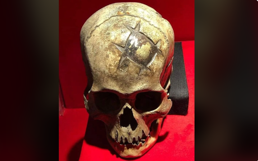 The Ancient Art of Cranioplasty: A Remarkable Medical Feat from Ancient Peru