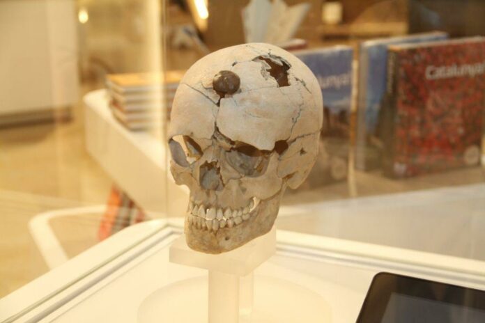 Unveiling Ancient Valor: The Astonishing Iron-Nailed Skull of a Young Warrior Reveals Hidden Tales