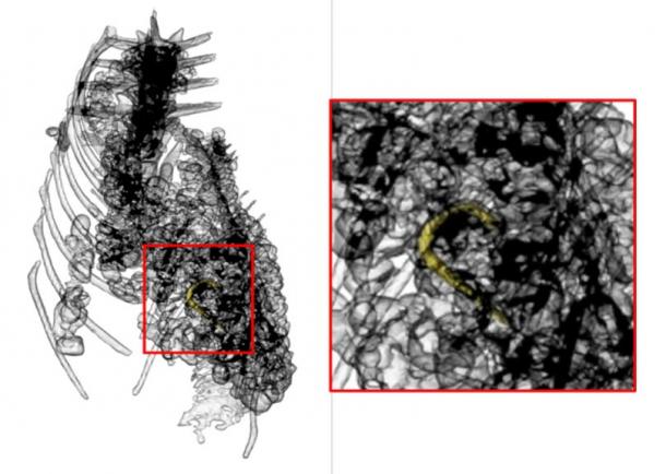 The X-ray of the crocodile mummy, with gastroliths in stomach, with the hook highlighted. (University of Manchester)