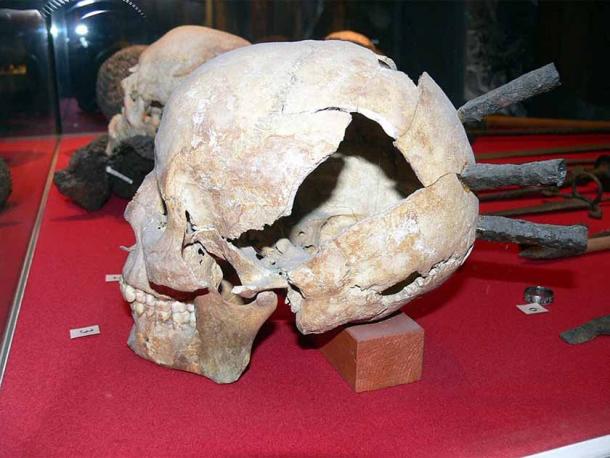 Unearthing History: Skull with Arrow Wounds Reveals the Gruesome Battle of Visby