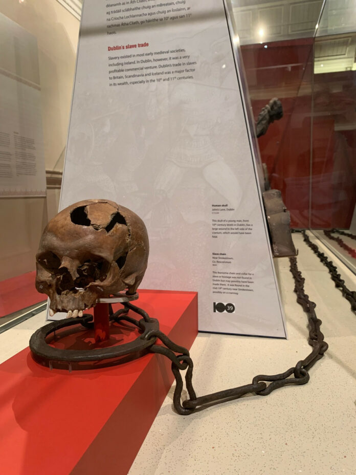 Silent Witnesses: Exploring Human Remains at the National Museum of Ireland