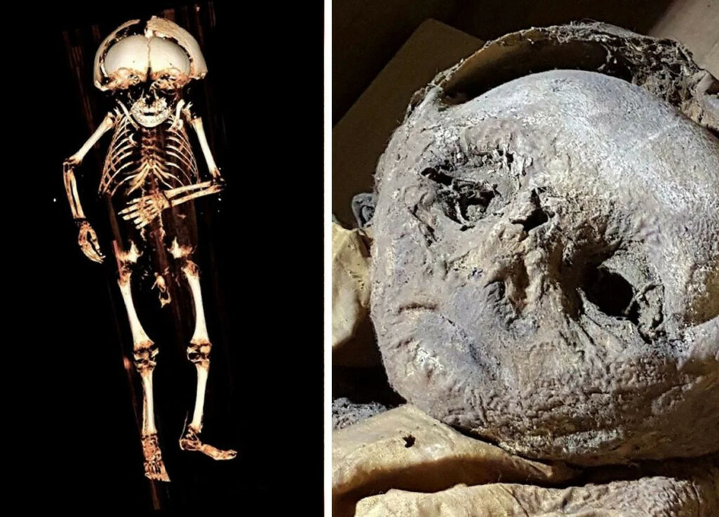 Renaissance Mystery Unveiled: CT Scan Shows Toddler Died from ‘Complete Lack of Sunlight