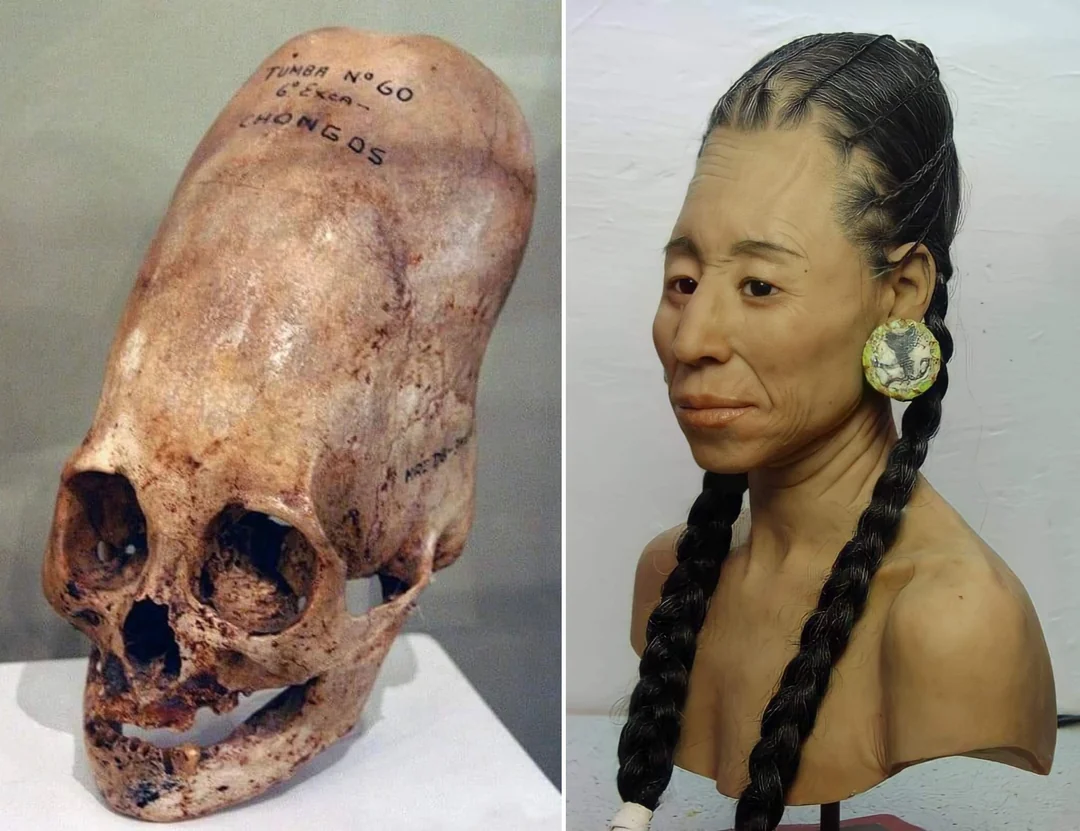 Unveiling the Enigma of the Paracas Elongated Skulls