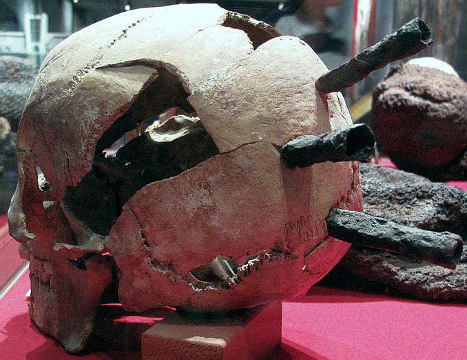 Uncovering the Grim Realities of Medieval Warfare: The Skull with Three Crossbow Bolt Wounds from the Battle of Visby