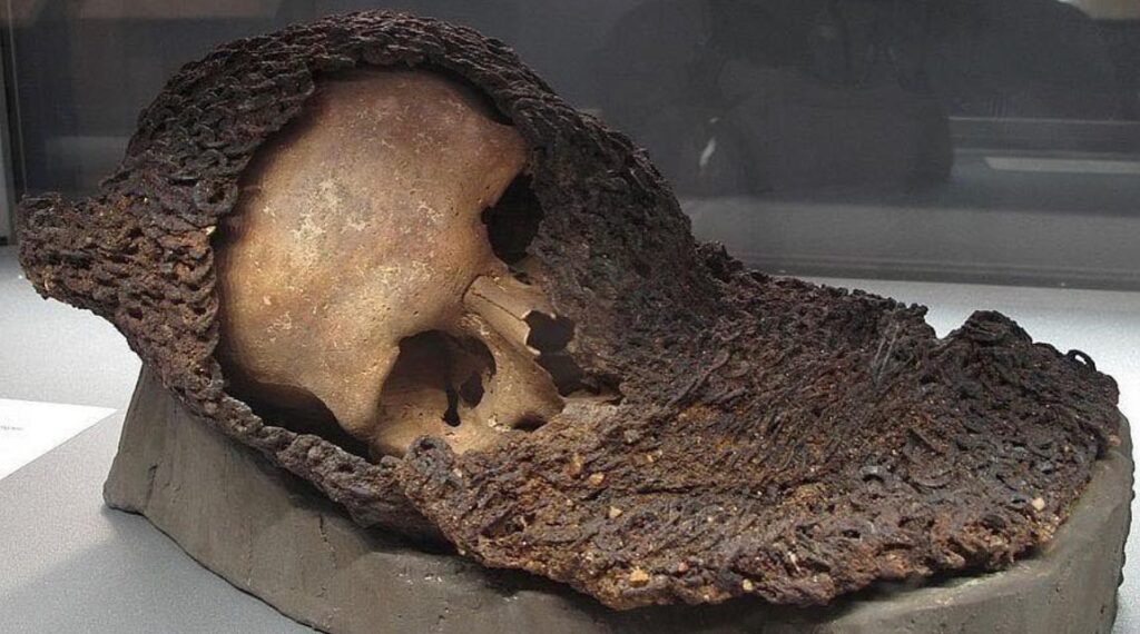 Uncovering the Secrets of the Battle of Visby: A Soldier’s Skull Fused with Chainmail