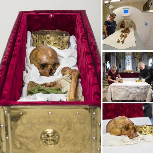 Bones Tell a Story: The Osteological Investigation of a Medieval Monarch