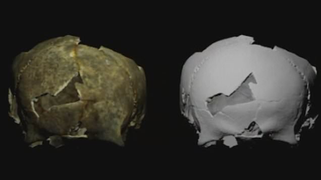 Unearthing the Past: 5,000-Year-Old Skull Reveals Ancient Brain Surgery