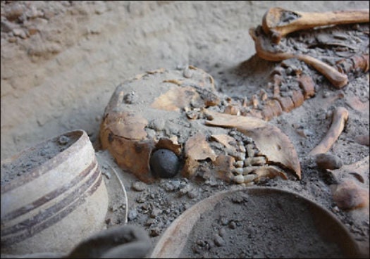 The 4,800 Year Old Artificial Eye | WIRED