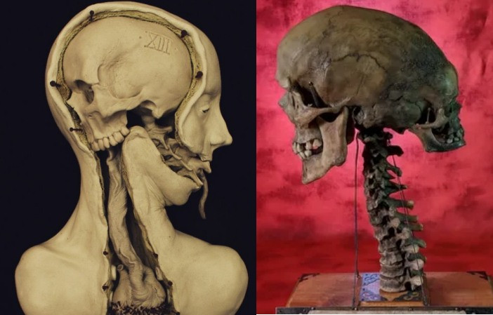 The Enigma of the Two-Headed Skull: Unraveling Secrets Through Archaeological Autopsy