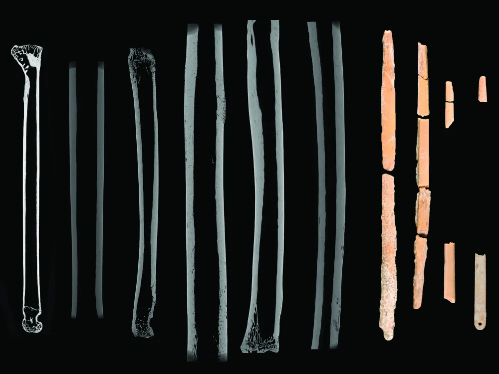 Bone needle scans