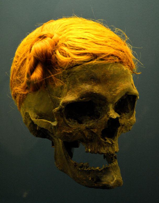 The "Osterby Man" was found in a peat bog in 1948 near Osterby, Germany and  has been dated to between 75 and 130 CE. He sports a Suebian knot, a  hairstyle associated